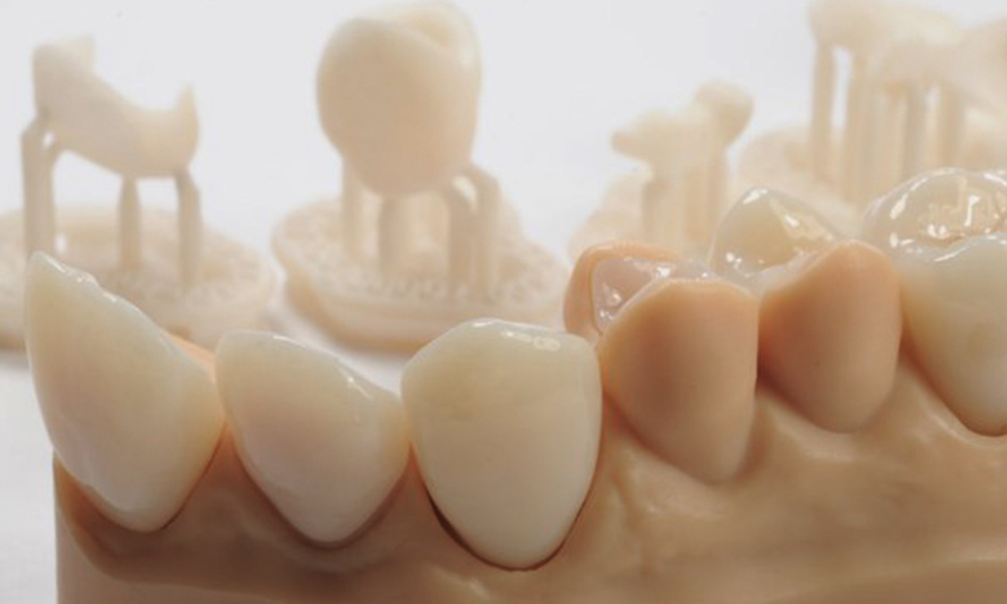 Resine dentali per stampa 3D Formazione e Informazione, Ricerca e Sviluppo  - Dental CLUB