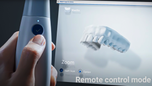 media telecamera intraorale scanner impronta digitale