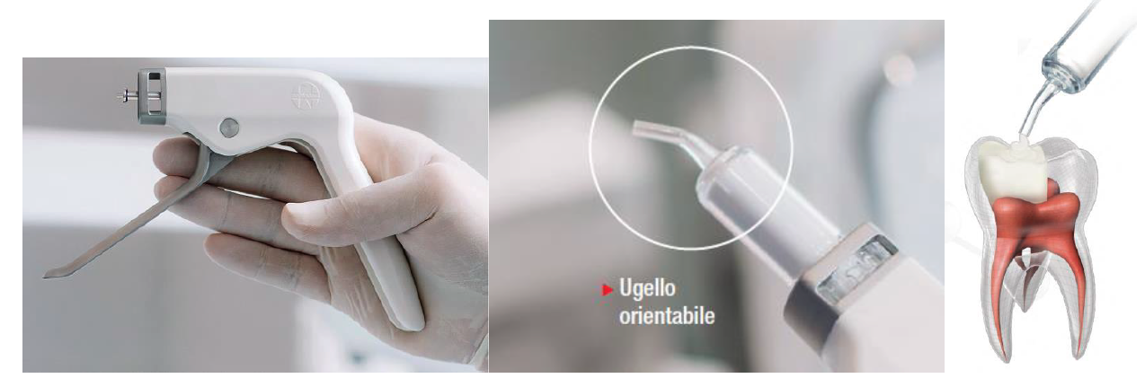 posizionamento diretto biodentine XP septodont dental club