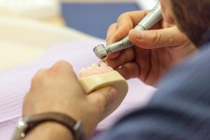 2016 Corso protesi Dott. D’Amelio 2 Dental Club